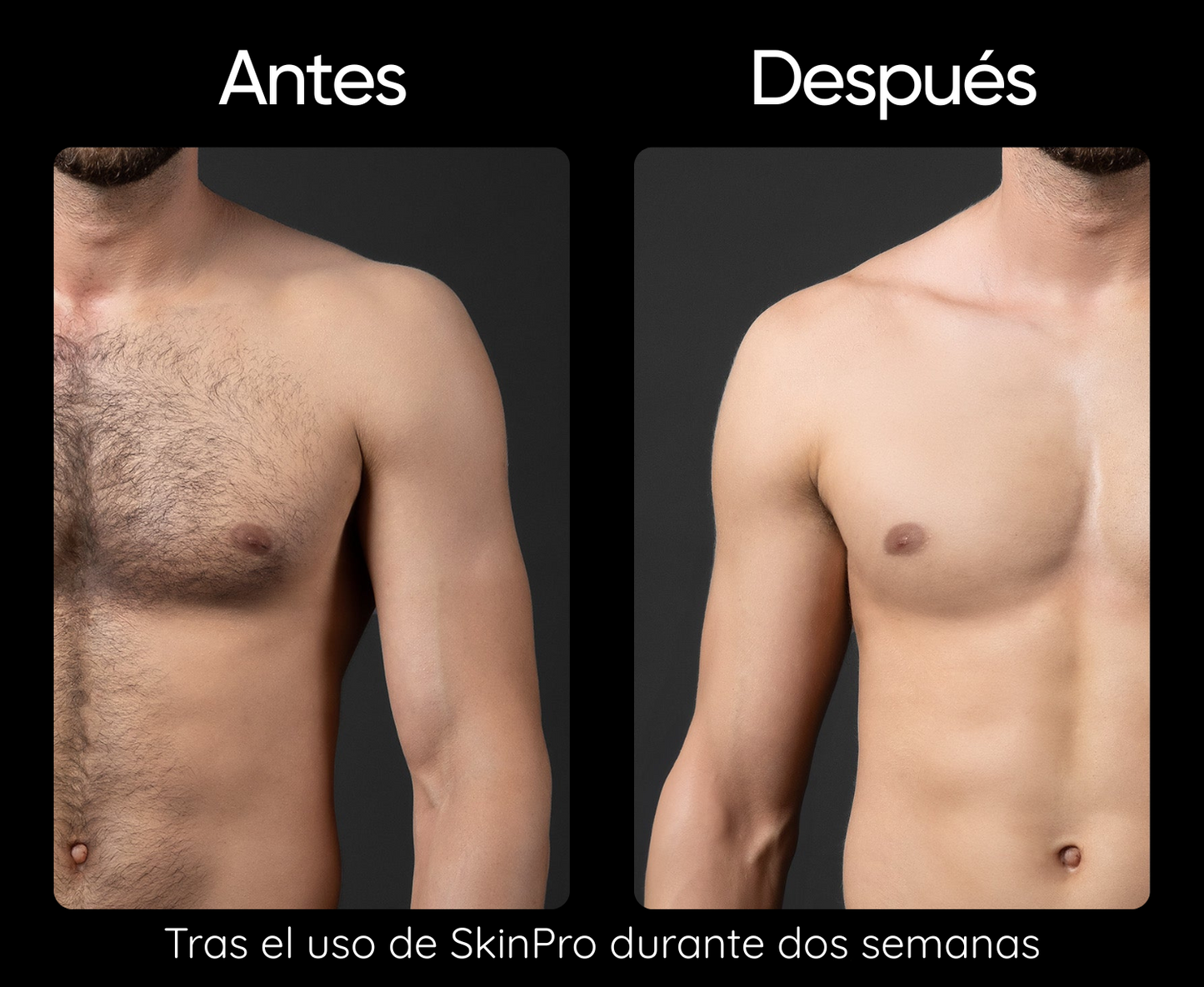 SkinPro | Depiladora Láser Permanente