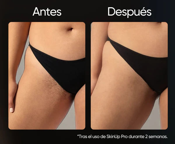SkinPro | Depiladora Láser Permanente